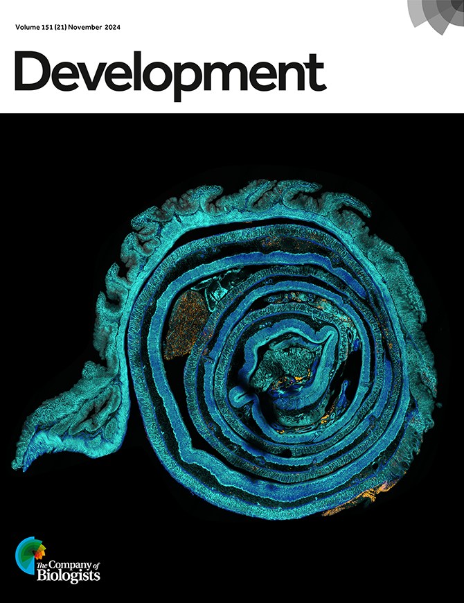 Development